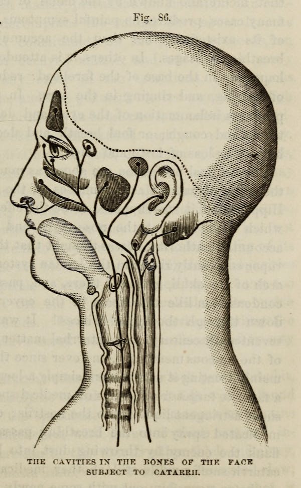 Diagram of health advice