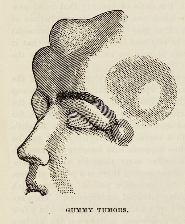 Diagram of health advice